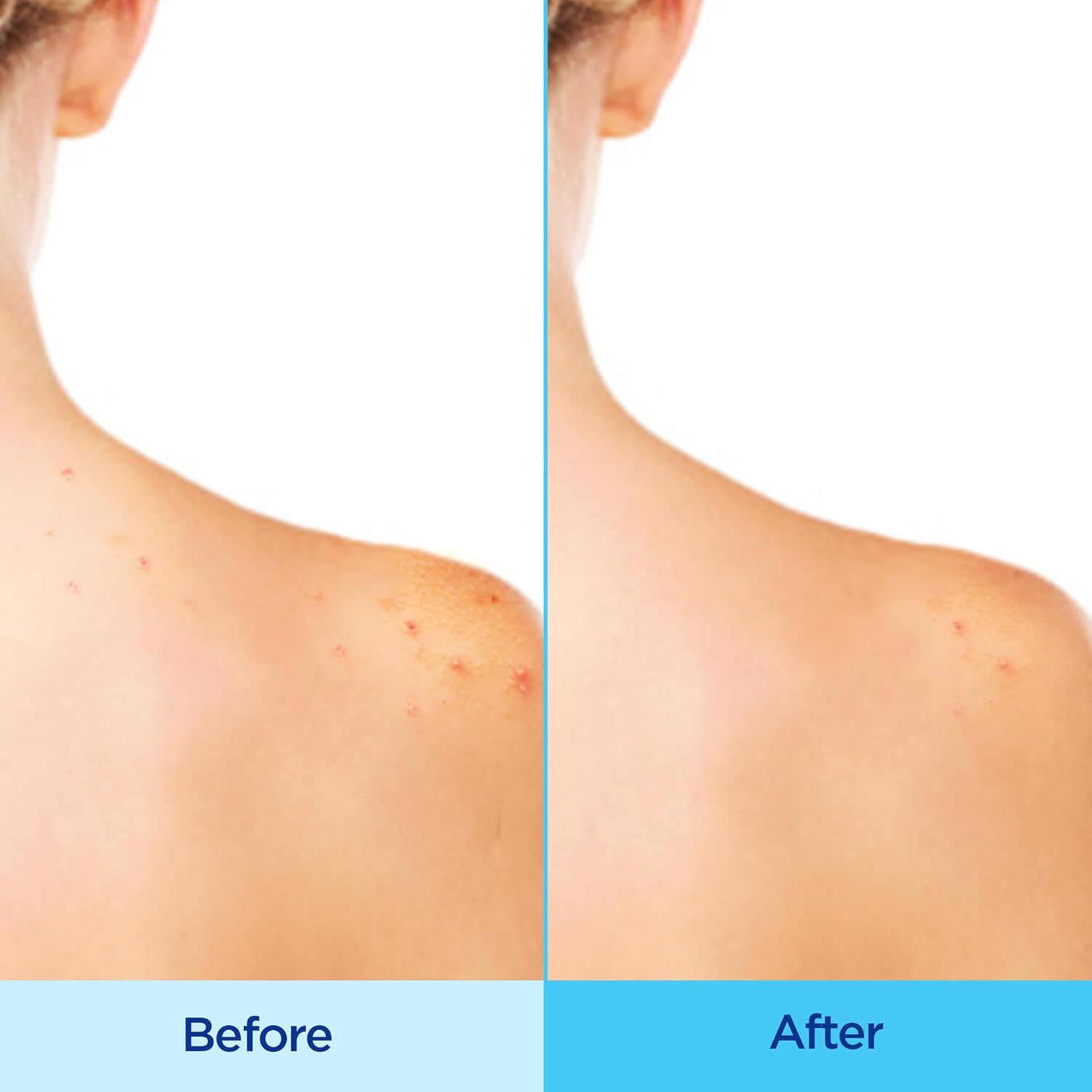 2.5% witch hazel to control surface oil and minimize pore appearance