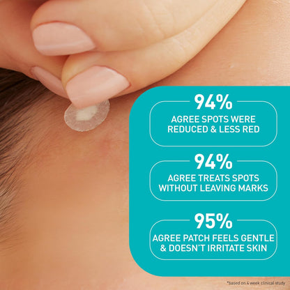 CeraVe Blemish Barrier Patches for Acne-Prone Skin, Overnight Self-Care Spot Treatment for a Calming Bedtime Ritual