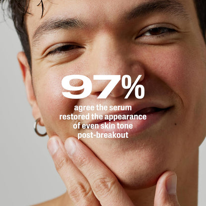 Cetaphil Gentle Clear Repairing Post-Acne Serum – Mindful Nightly Ritual for Sensitive Skin, Bakuchiol Brightening Treatment