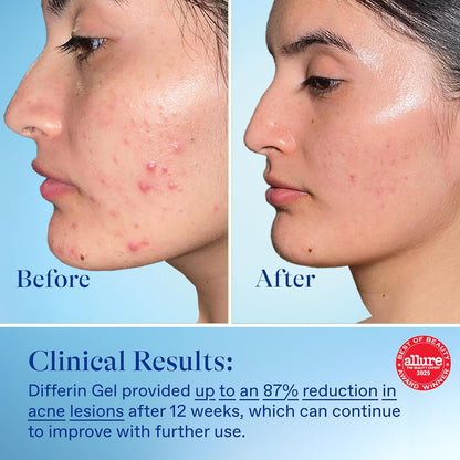 dermatologist-recommended formula designed for superior tolerability vs. other retinoids