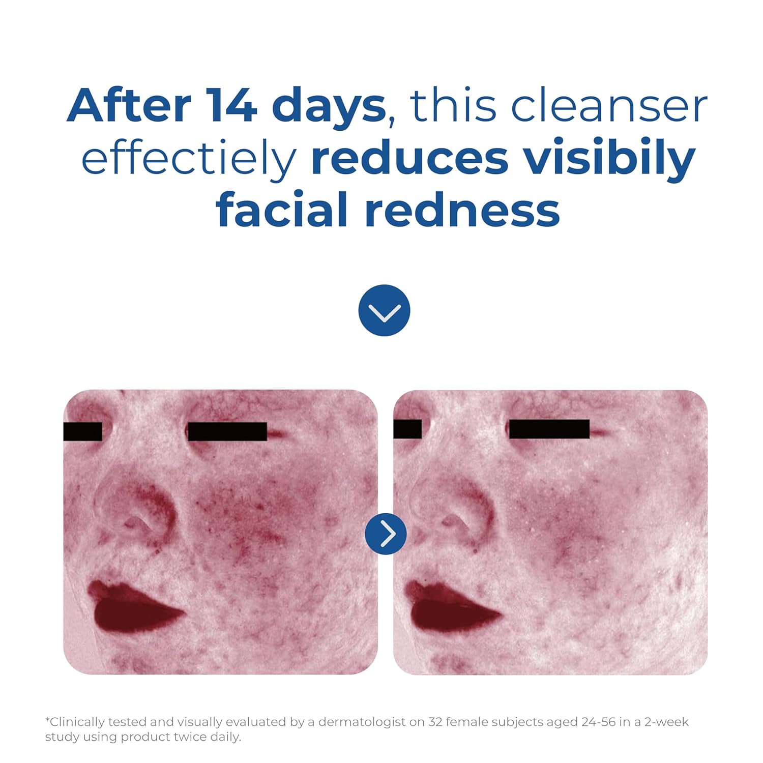 EltaMD Amino Acid Foaming Cleanser – Streamlined Daily Face Wash for Clean Skincare Routines