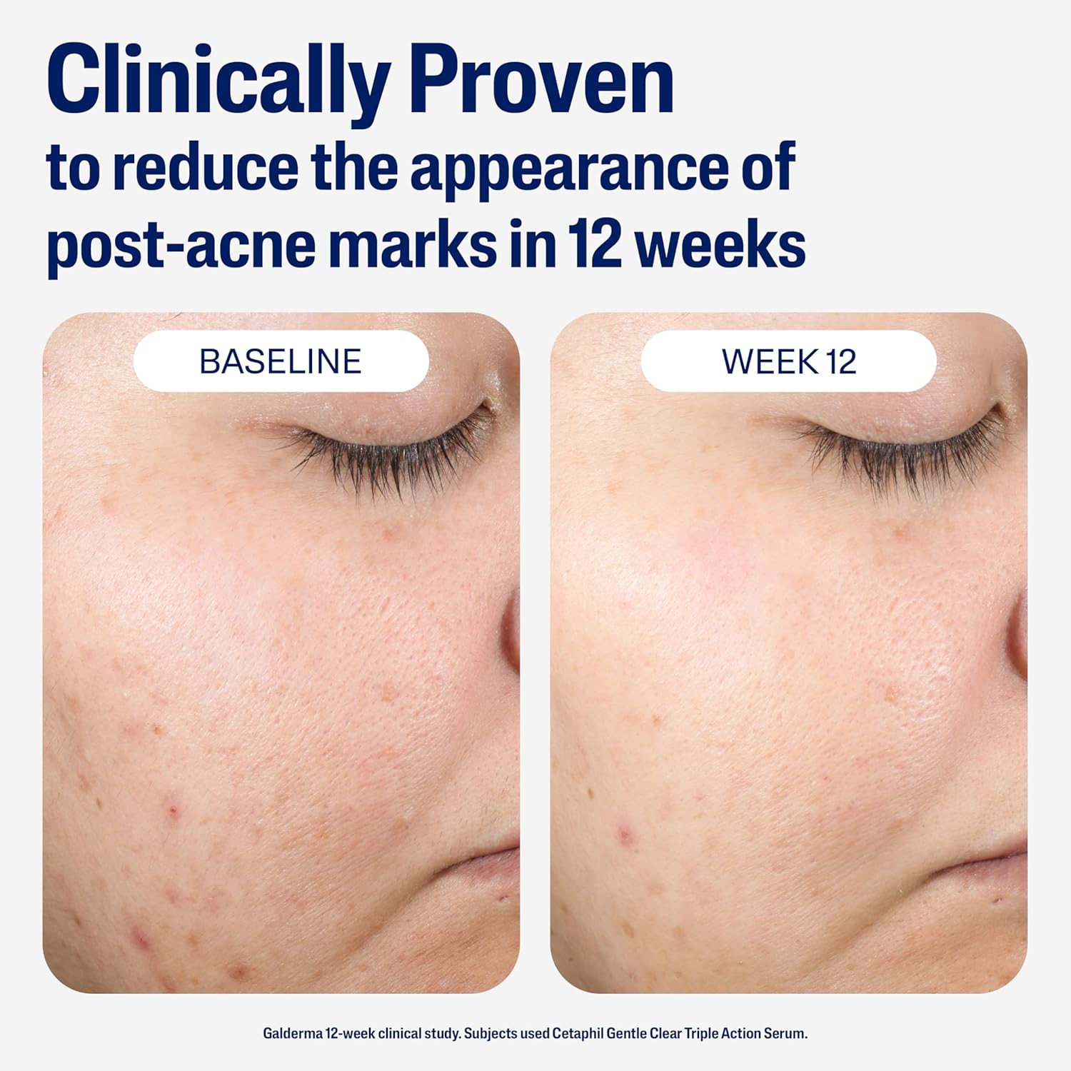 hypoallergenic, fragrance-free, oil-free, and non-comedogenic formulation