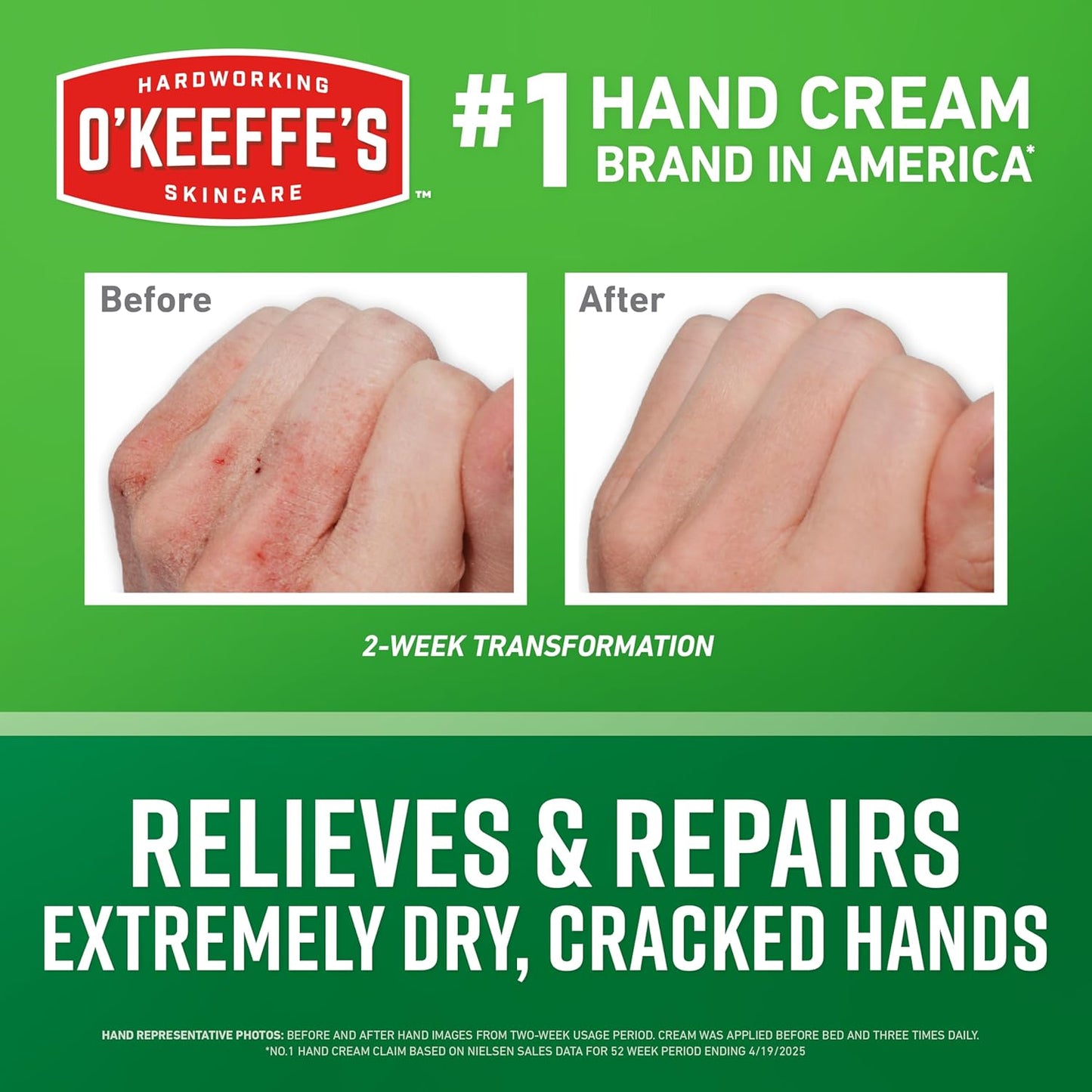 hypoallergenic, unscented, non-greasy formula that is safe for people with diabetes