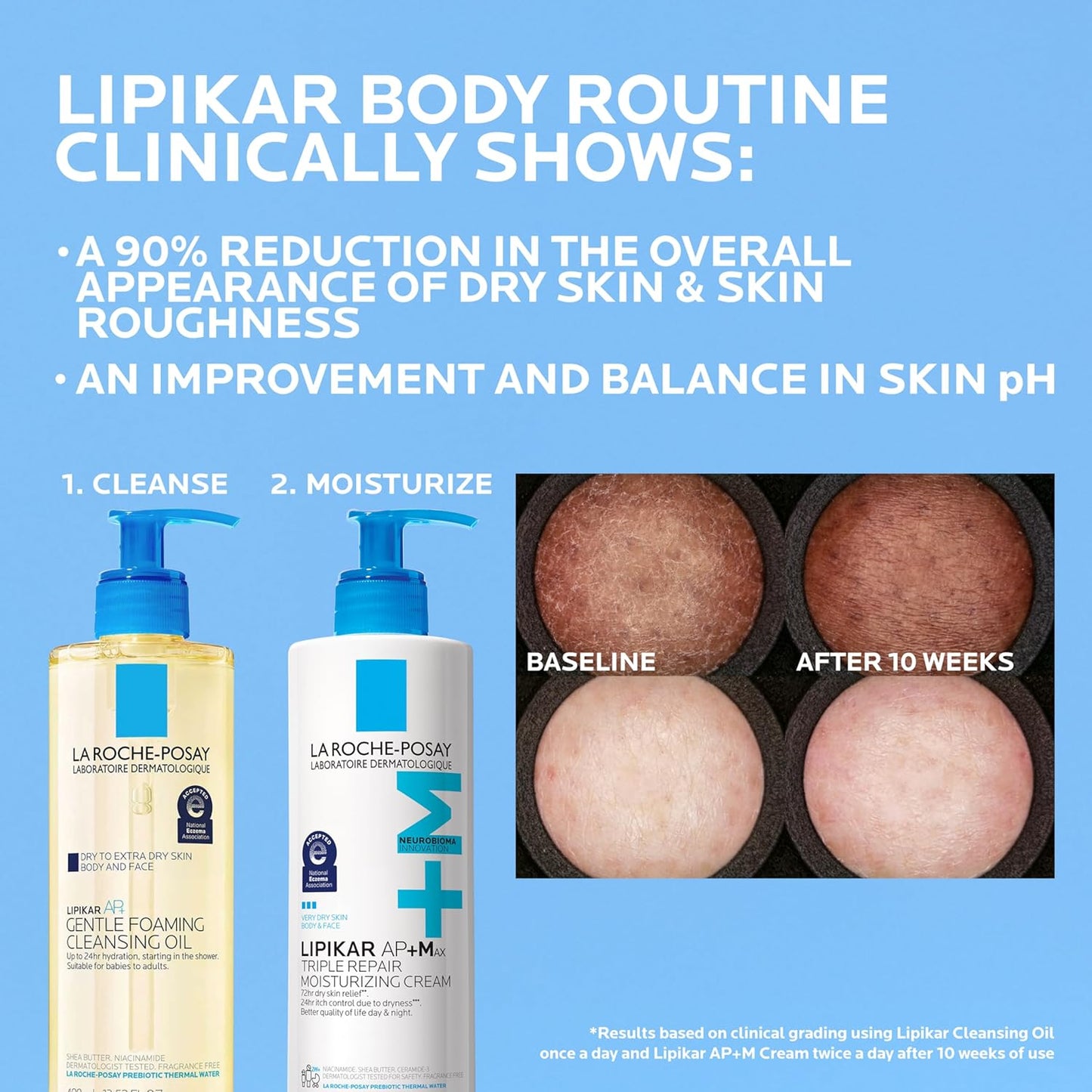 La Roche-Posay Lipikar AP+MAX Medical-Grade Body Cream | Clinically Proven Safe for Chemotherapy & Radiation Patients