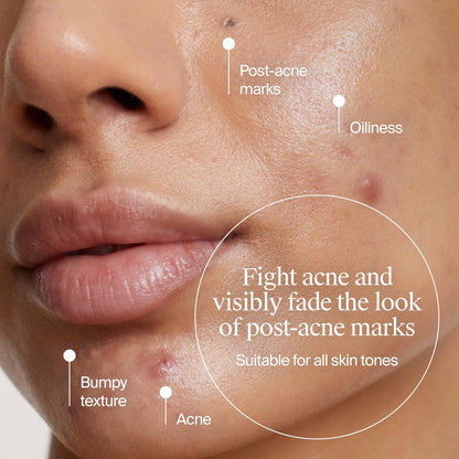 patented barriercare technology that respects the skin's moisture barrier
