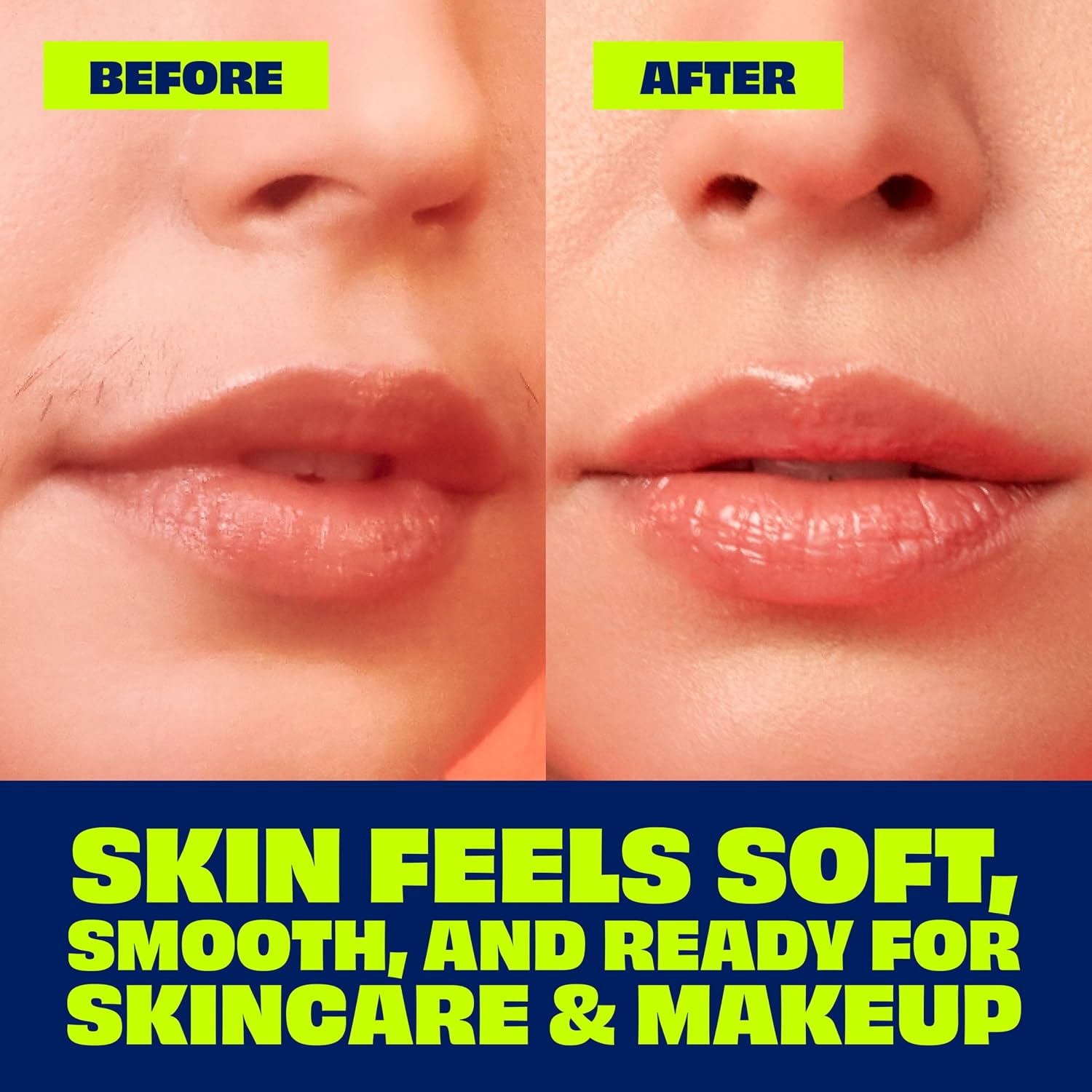 targeted for upper lip, chin, and cheek areas; available in single or 2-pack