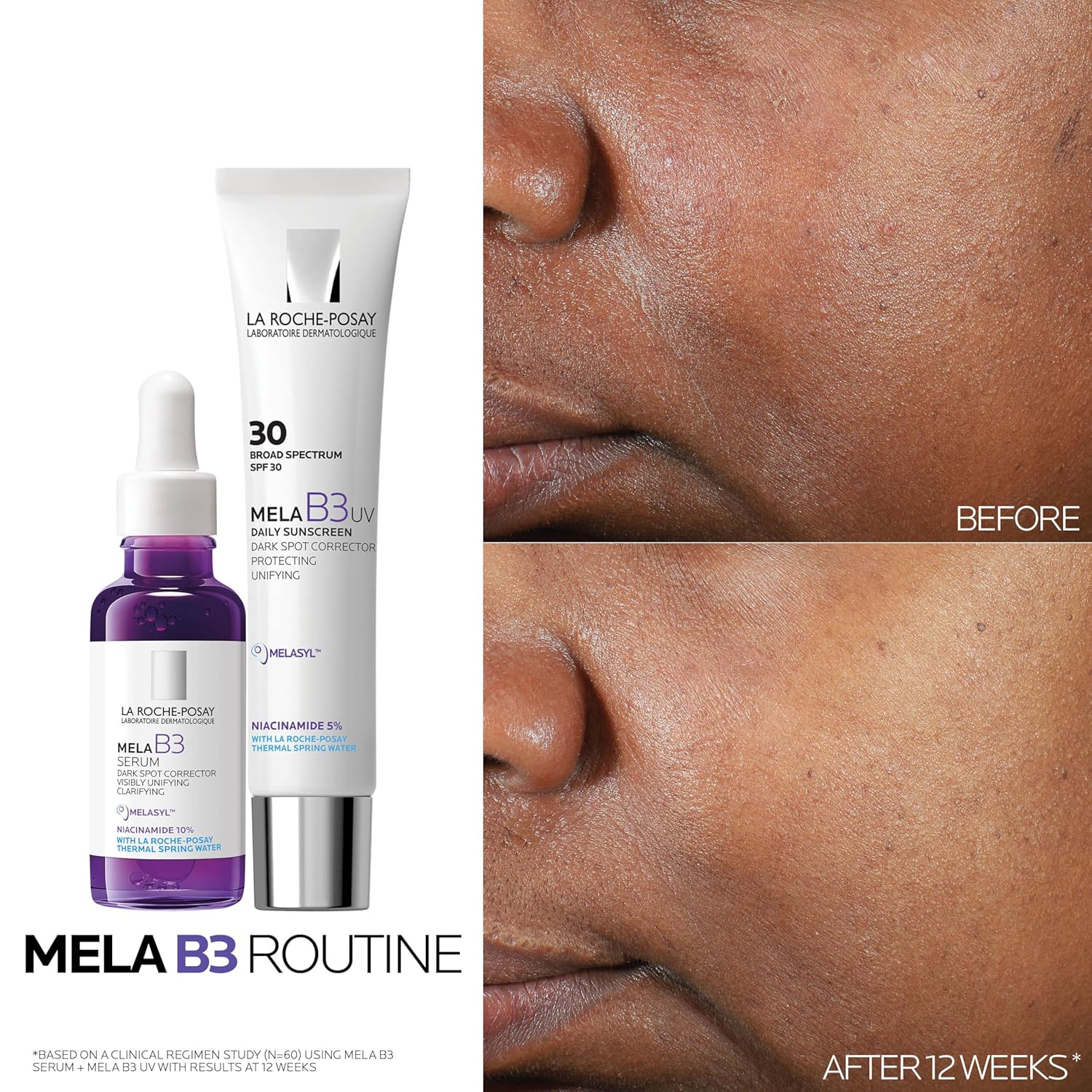 targets multiple discoloration types: sun spots, age spots, liver spots, and post-acne marks